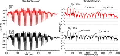 Neural Representation of the English Vowel Feature [High]: Evidence From /ε/ vs. /ɪ/